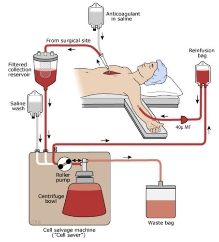 Bloodless Medicine and Surgery